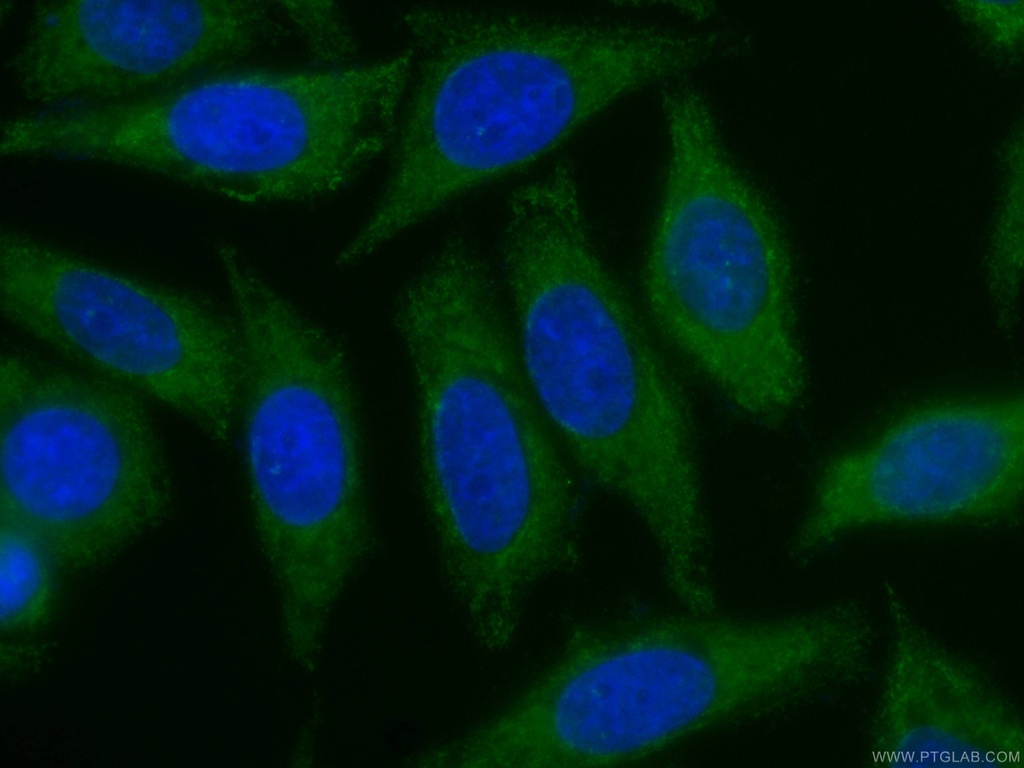 CoraLite®488-conjugated ZC3HAV1 Monoclonal antibody