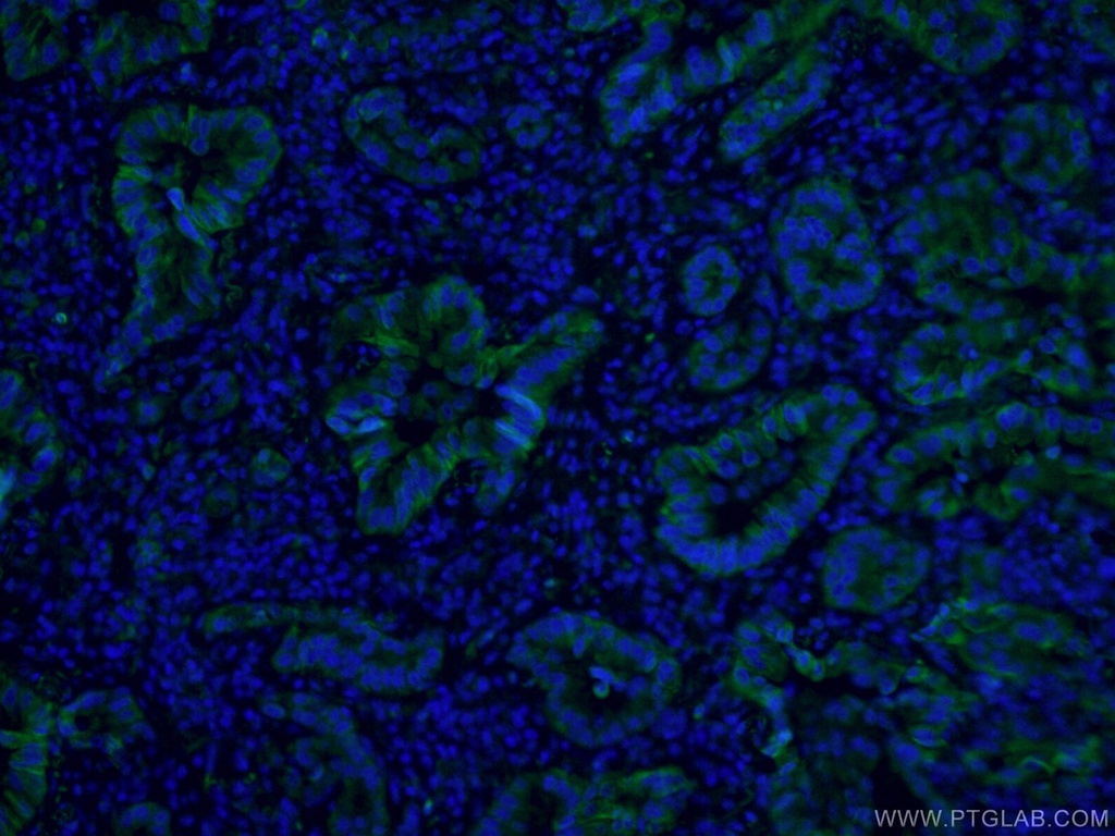 CoraLite®488-conjugated Cytokeratin 7 Monoclonal antibody