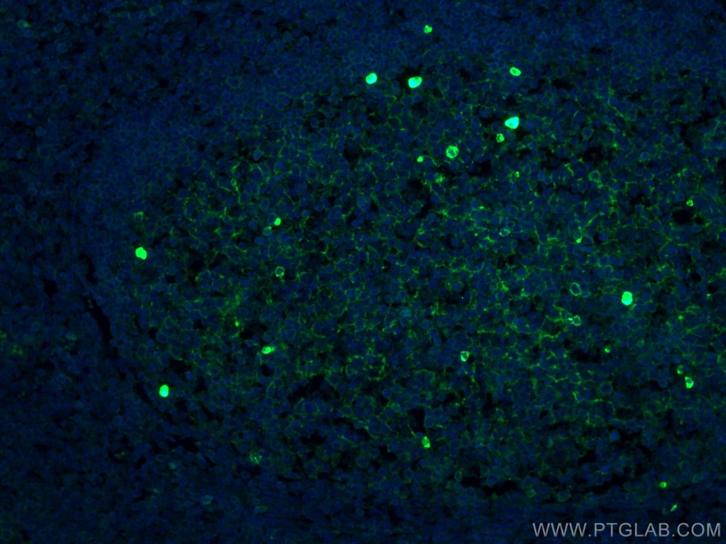 CoraLite®488-conjugated human IgM Monoclonal antibody