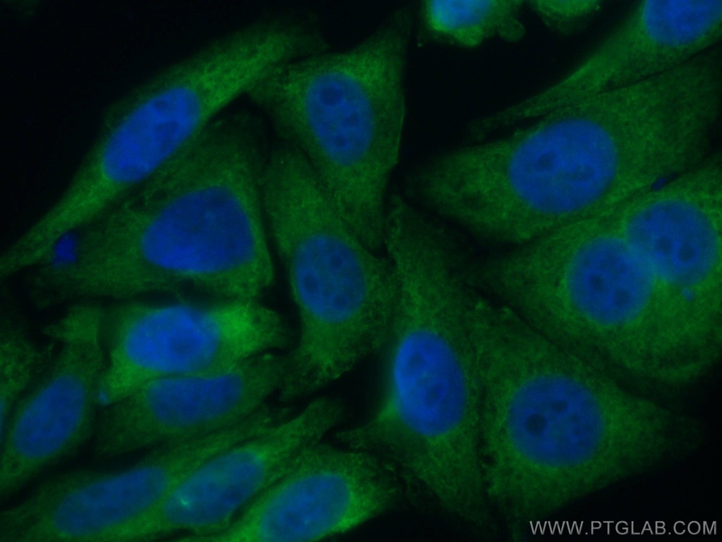 CoraLite®488-conjugated TWIST2 Monoclonal antibody