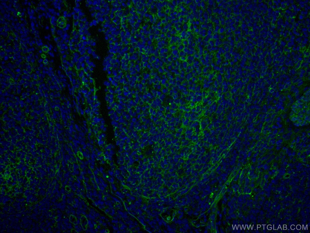 CoraLite®488-conjugated CD151 Monoclonal antibody