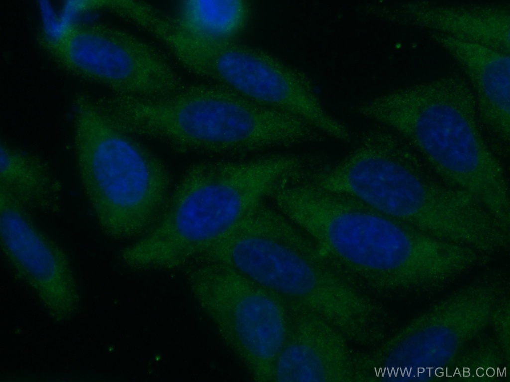 CoraLite®488-conjugated Catalase Monoclonal antibody