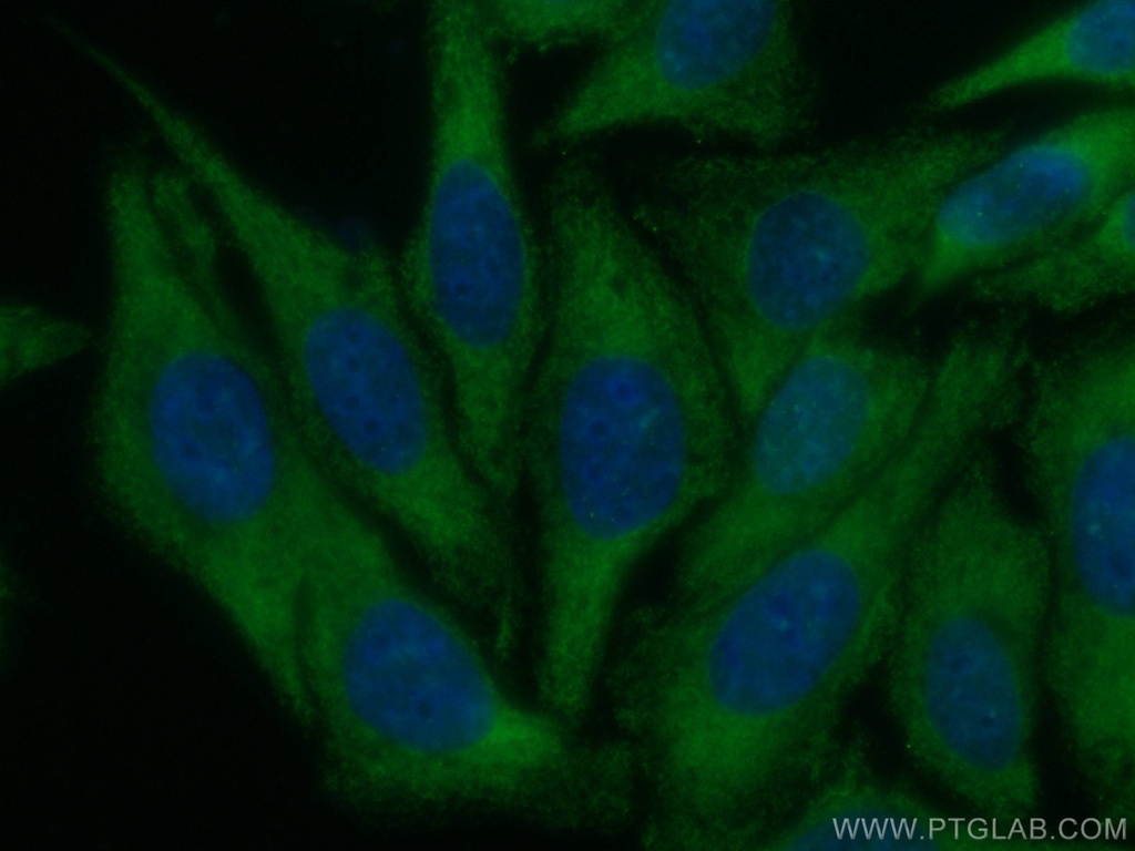 CoraLite®488-conjugated SREBF1 Monoclonal antibody