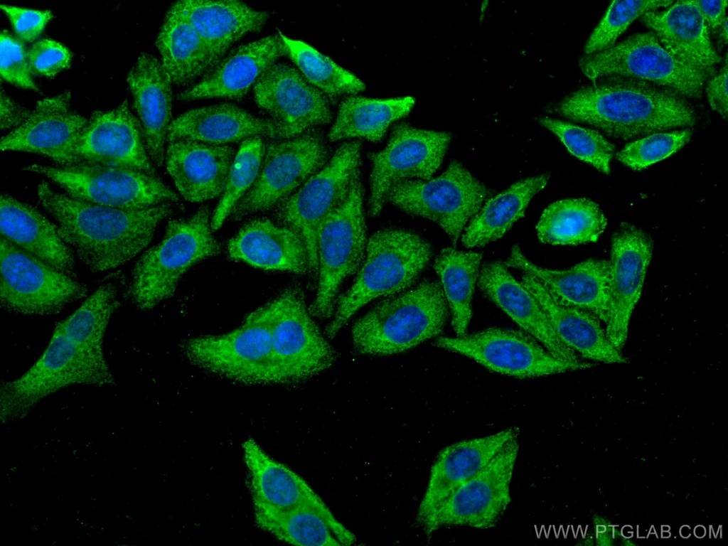 CoraLite®488-conjugated FGFR3 Monoclonal antibody