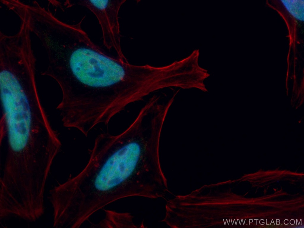 CoraLite®488-conjugated TBL1X Monoclonal antibody