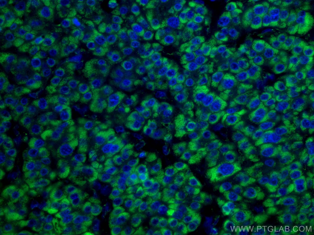 CoraLite®488-conjugated GLUD1 Monoclonal antibody