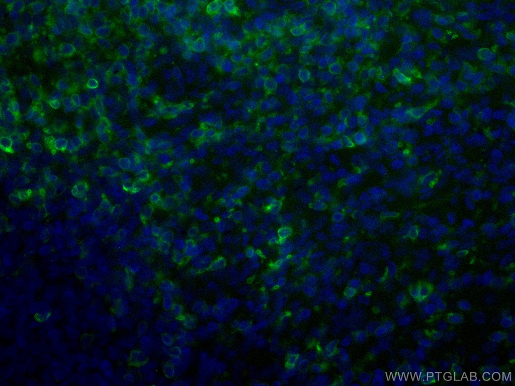 CoraLite®488-conjugated CD5 Monoclonal antibody