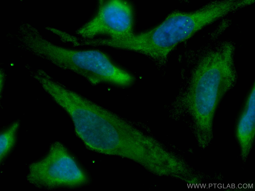 CoraLite®488-conjugated ATG7 Monoclonal antibody