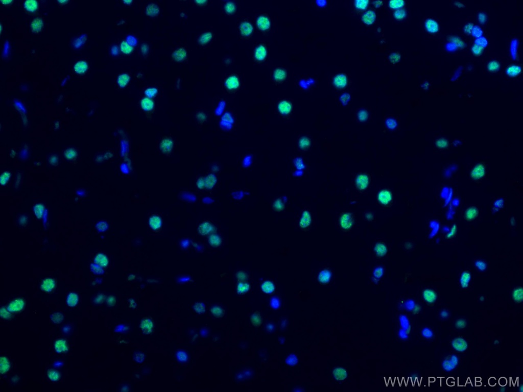 CoraLite®488-conjugated TDP-43 (C-terminal) Monoclonal antibody