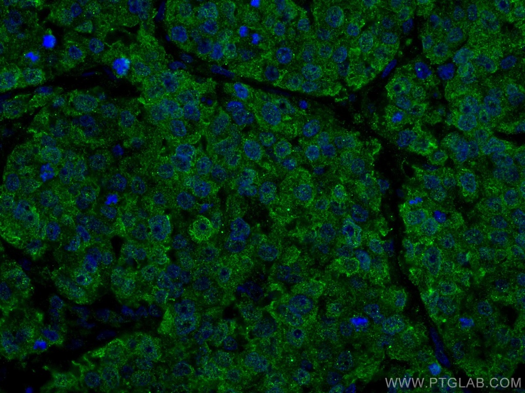 CoraLite®488-conjugated ANAPC5 Monoclonal antibody