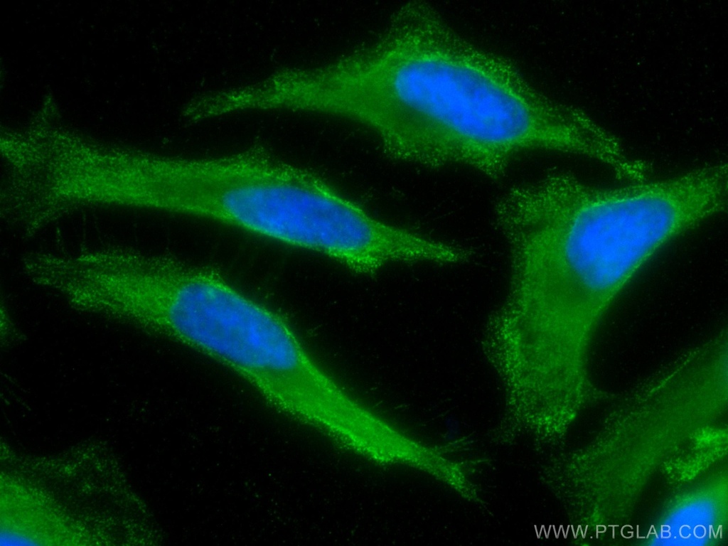 CoraLite®488-conjugated ALDH9A1 Monoclonal antibody