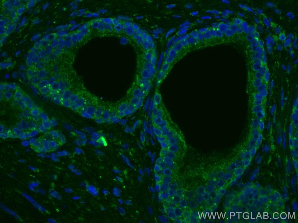 CoraLite®488-conjugated TAOK3 Monoclonal antibody
