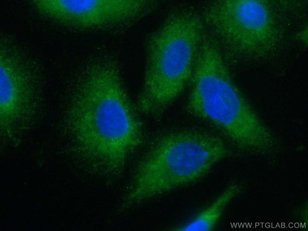 CoraLite®488-conjugated VPS18 Monoclonal antibody