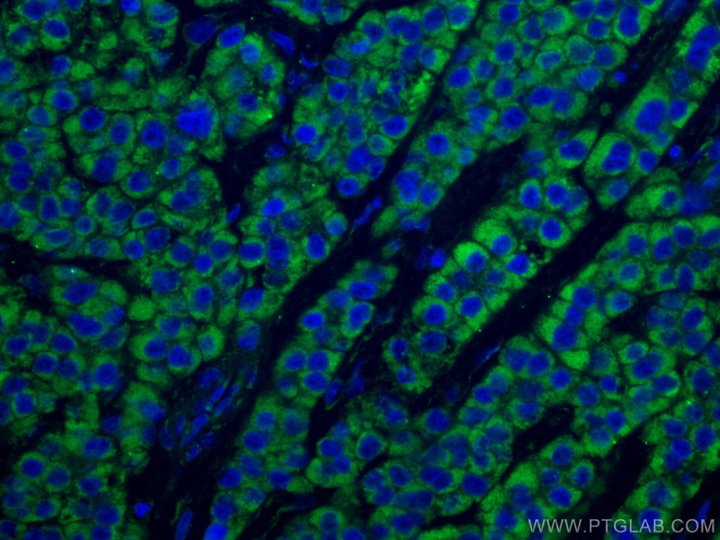 CoraLite®488-conjugated SDHB Monoclonal antibody