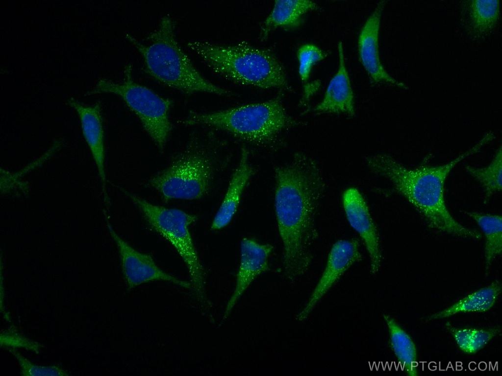 CoraLite®488-conjugated EPRS Monoclonal antibody