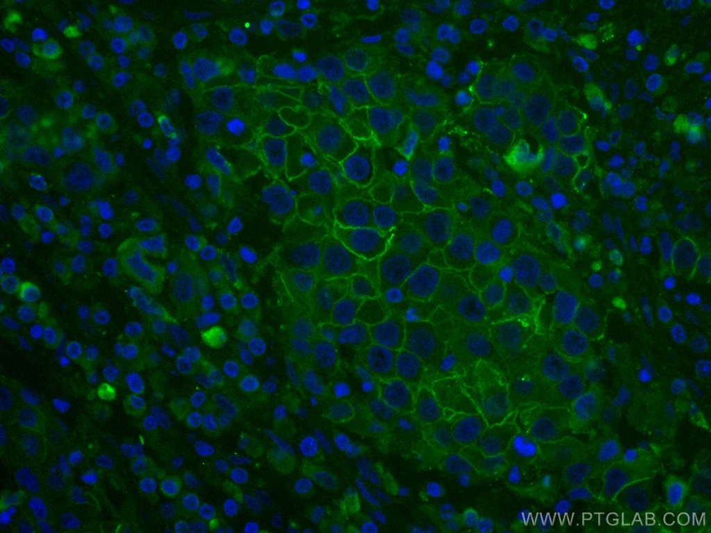 CoraLite®488-conjugated ALCAM Monoclonal antibody