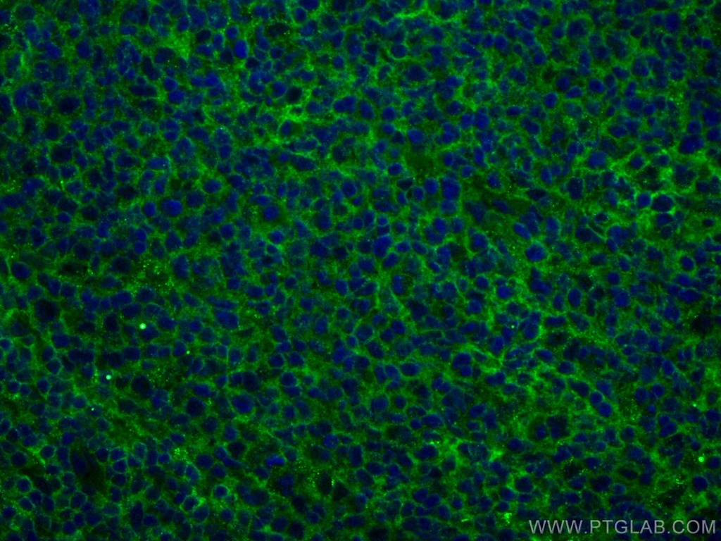 CoraLite®488-conjugated NT5E,CD73 Monoclonal antibody