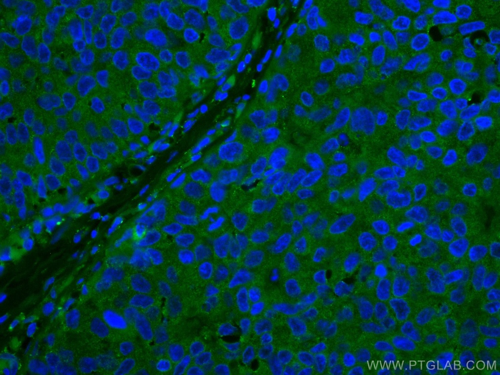 CoraLite®488-conjugated DAPK1 Monoclonal antibody
