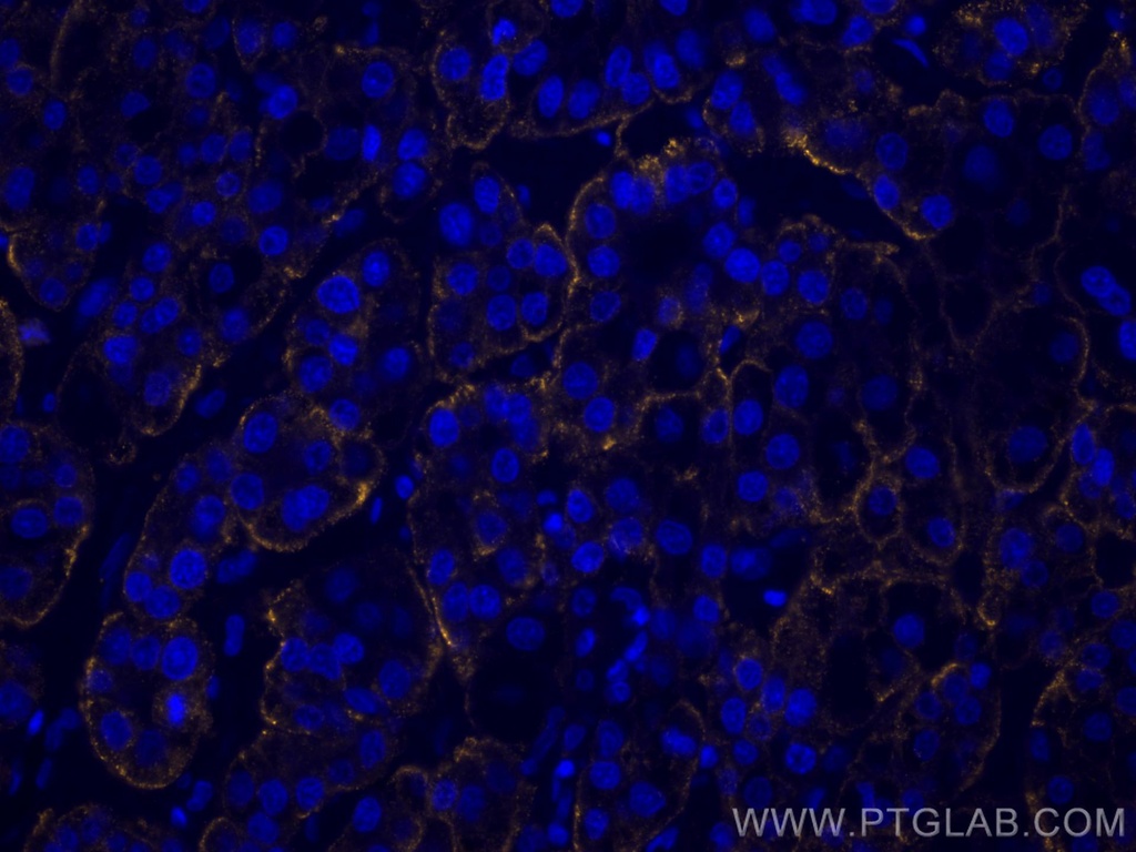 CoraLite®555-conjugated ASGR1 Polyclonal antibody