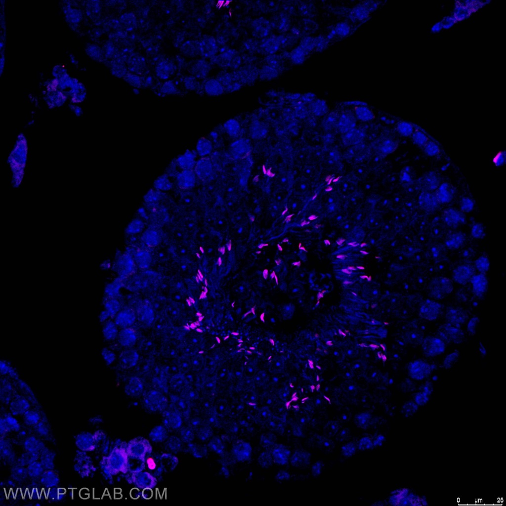CoraLite®555-conjugated TNP1 Polyclonal antibody