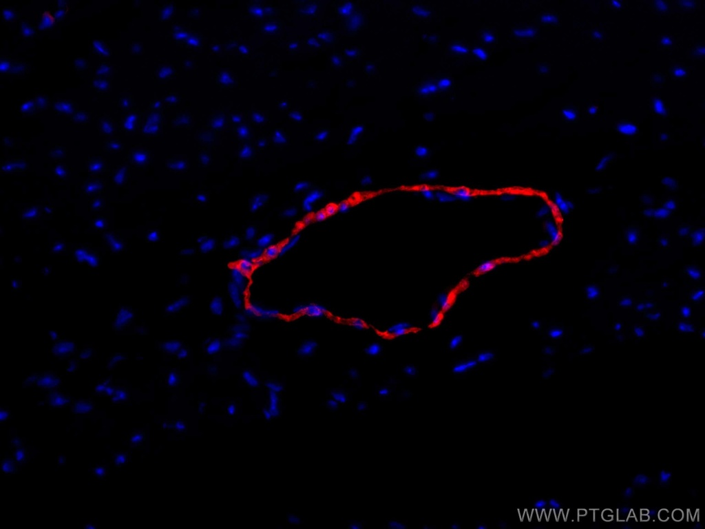 CoraLite®594-conjugated transgelin/SM22 Polyclonal antibody