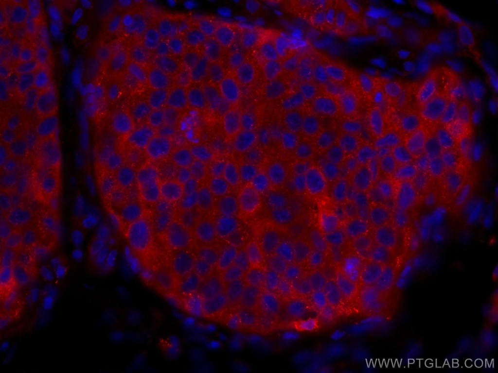 CoraLite®594-conjugated KEAP1 Polyclonal antibody