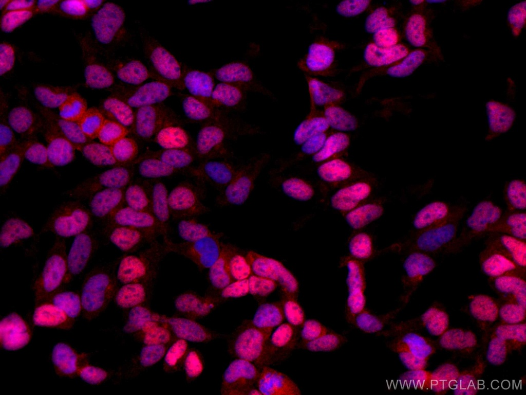 CoraLite®594-conjugated DACH1 Polyclonal antibody