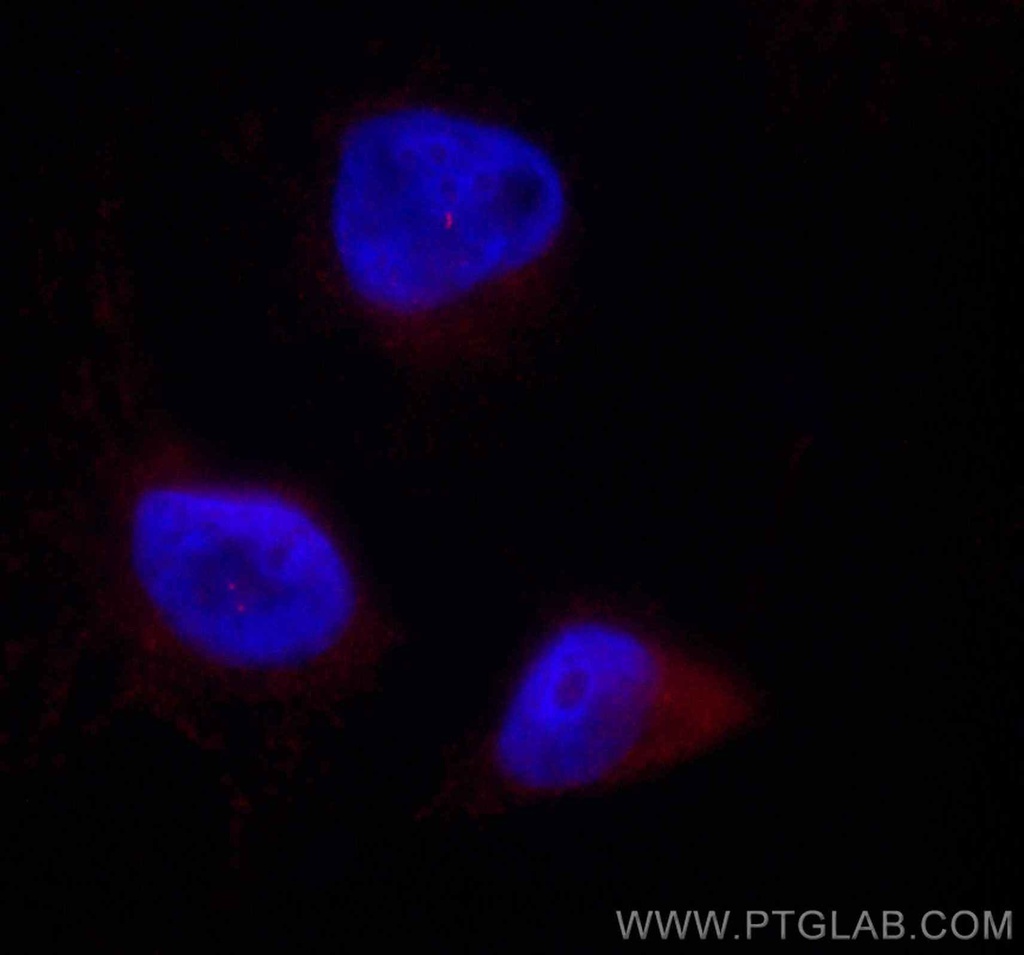CoraLite®594-conjugated CENPJ Polyclonal antibody