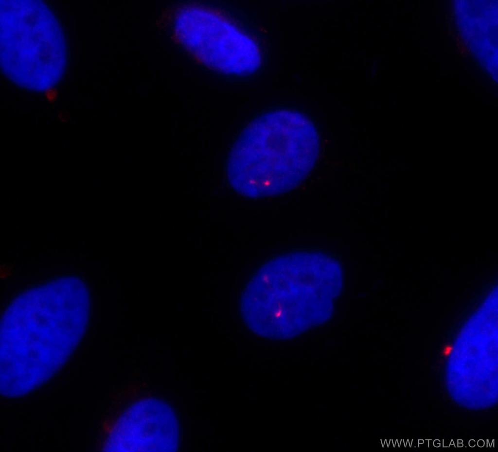 CoraLite®594-conjugated IFT81 Polyclonal antibody