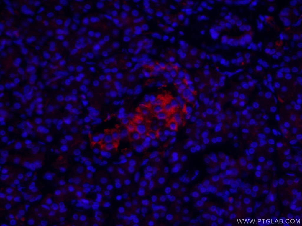 CoraLite®594-conjugated KRAP/SSFA2 Polyclonal antibody