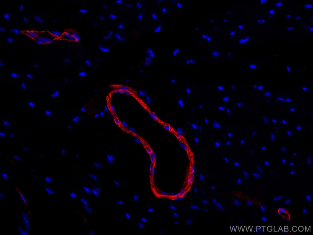 CoraLite®594-conjugated smooth muscle actin Polyclonal antibody