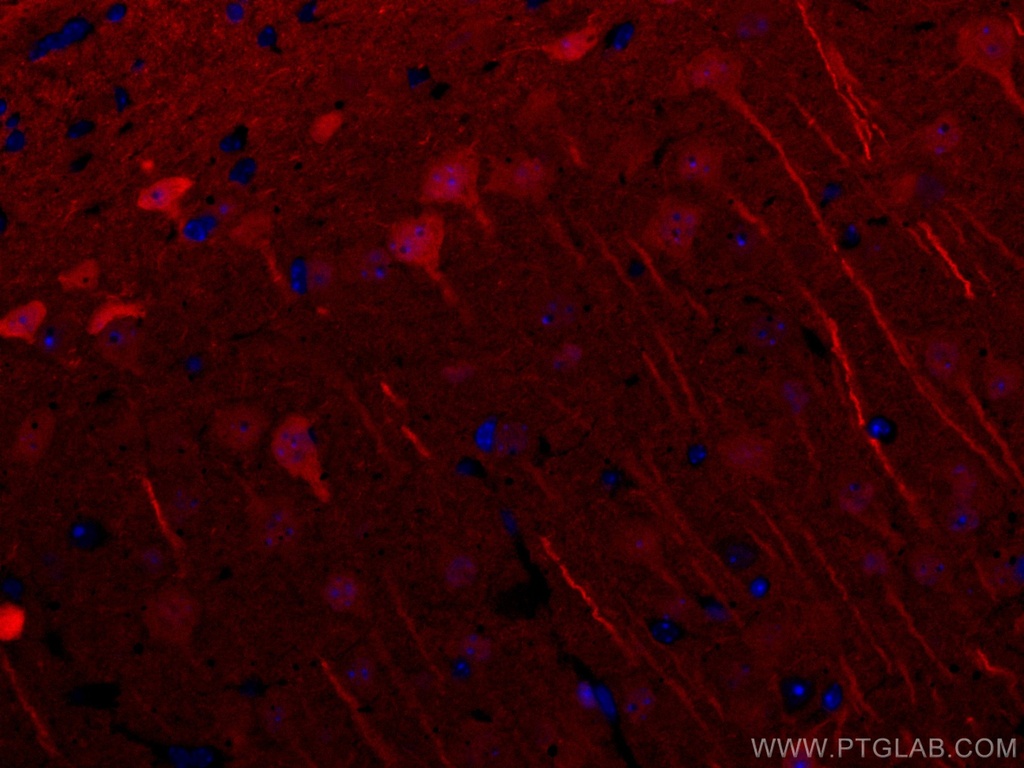 CoraLite®594-conjugated UCHL1/PGP9.5 Polyclonal antibody