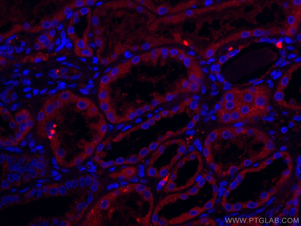 CoraLite®594-conjugated TCTN1 Polyclonal antibody