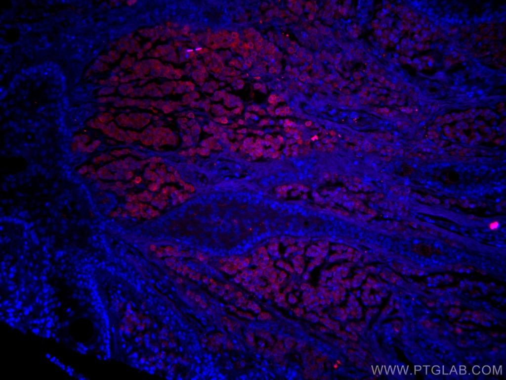 CoraLite®594-conjugated S100 Beta Polyclonal antibody