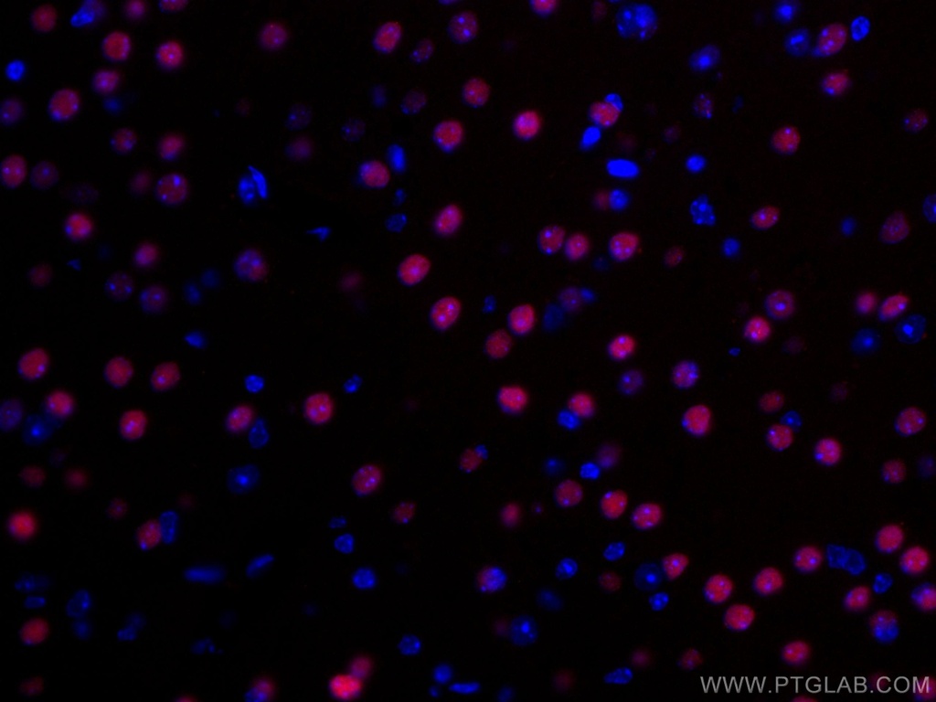 CoraLite®594-conjugated TBR1 Polyclonal antibody