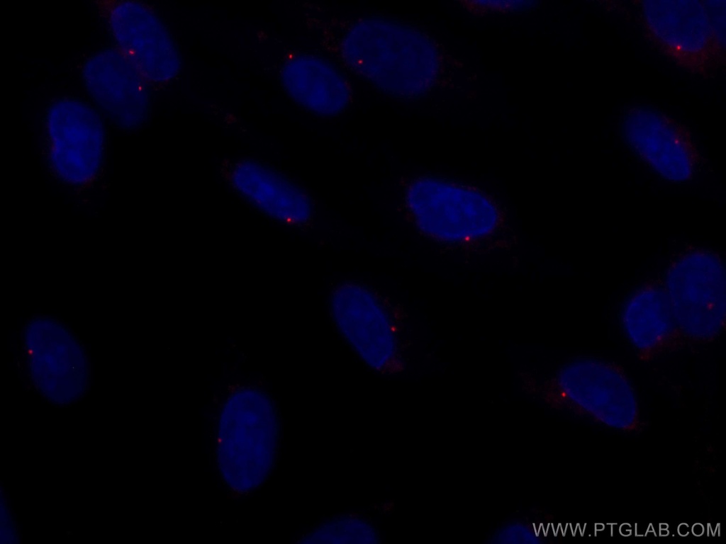 CoraLite®594-conjugated CEP164 Polyclonal antibody