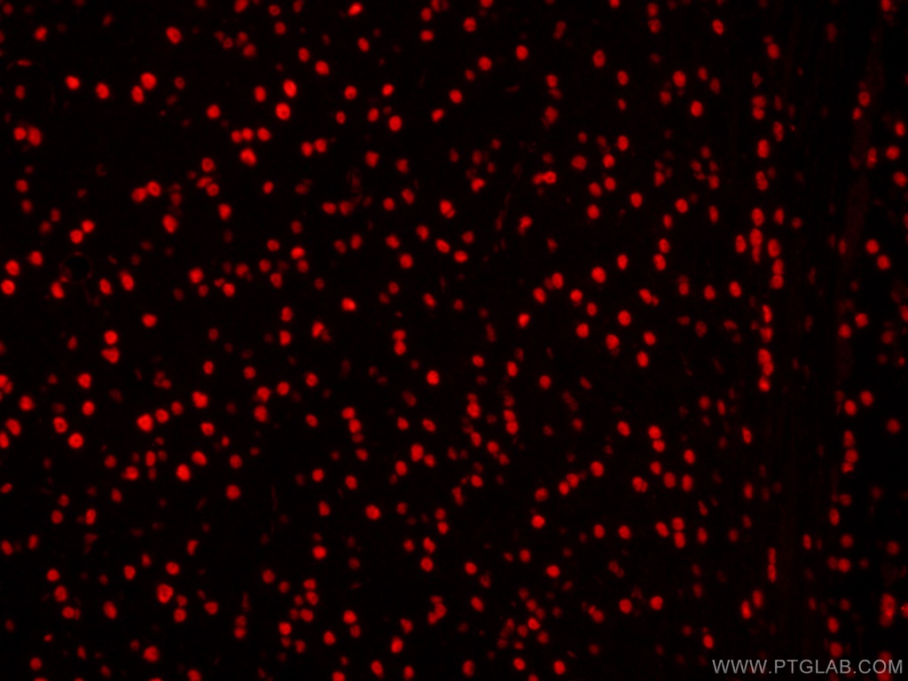 CoraLite®594-conjugated DACH1 Monoclonal antibody