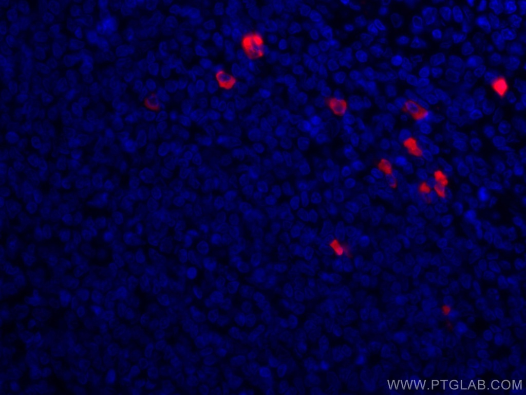 CoraLite®594-conjugated Human IgA Monoclonal antibody