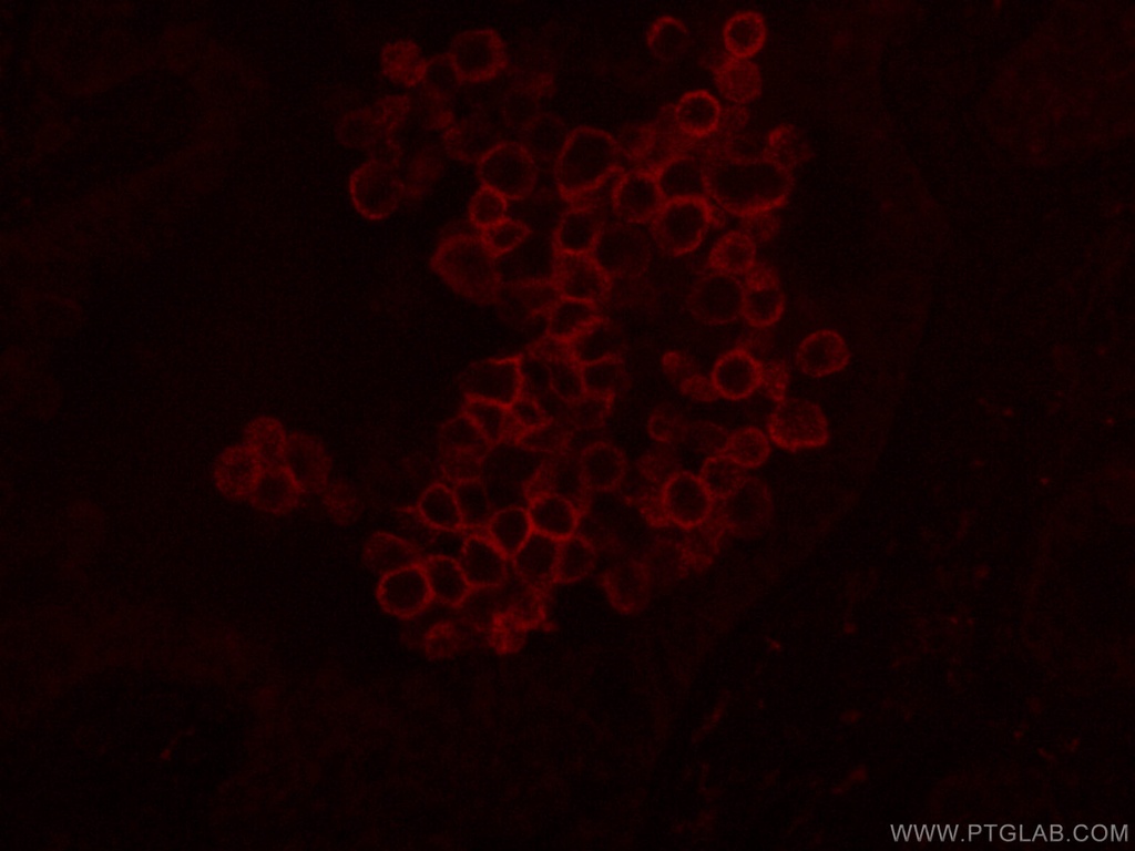 CoraLite®594-conjugated CD206 Monoclonal antibody