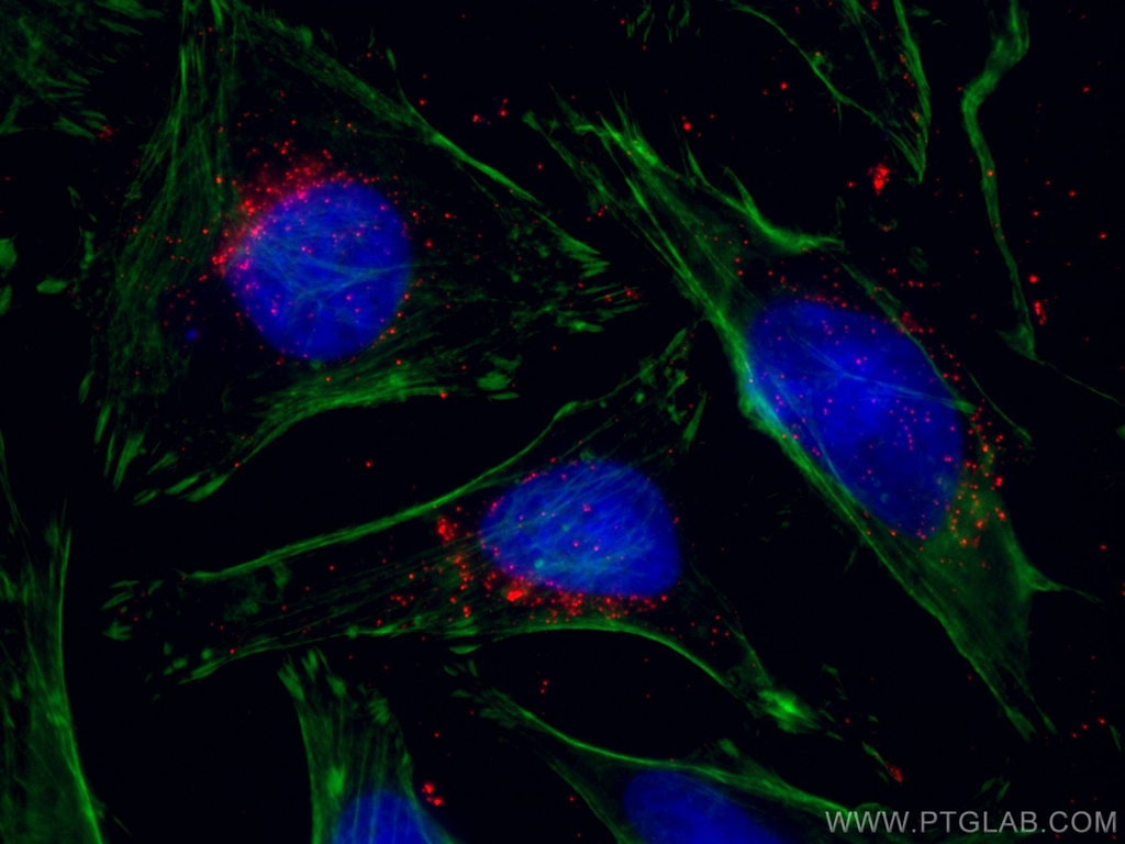 CoraLite®594-conjugated ABCD1 Monoclonal antibody