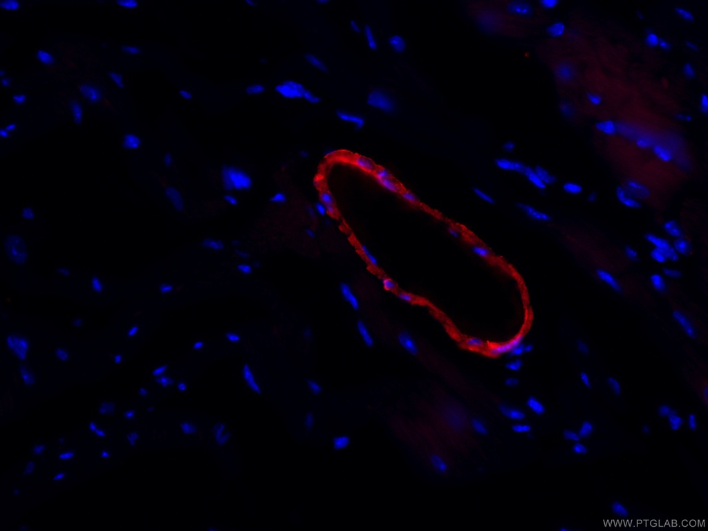 CoraLite®594-conjugated transgelin/SM22 Monoclonal antibody