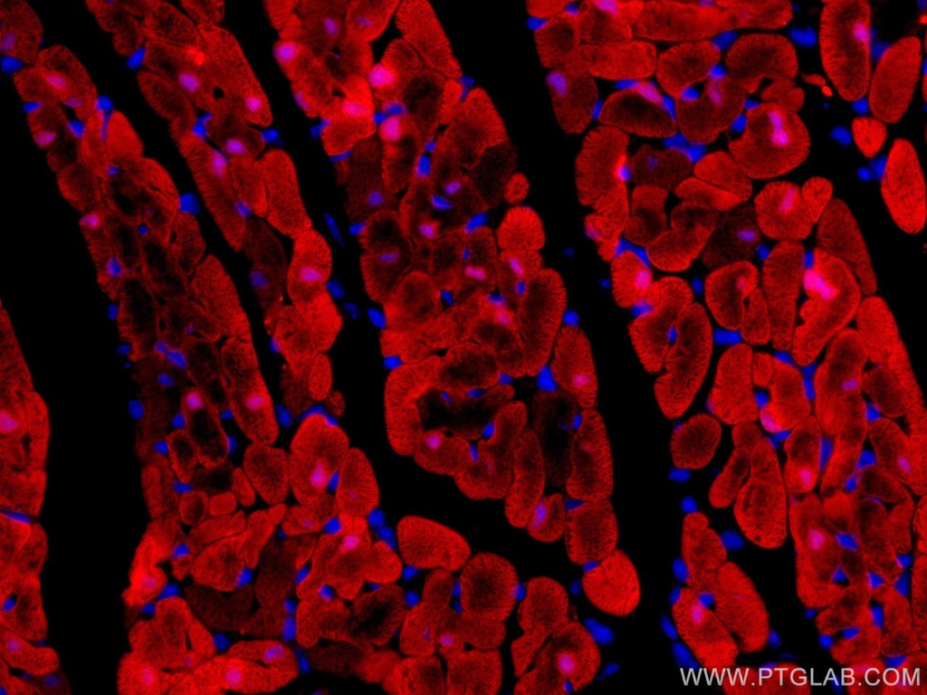 CoraLite®594-conjugated FABP3 Monoclonal antibody