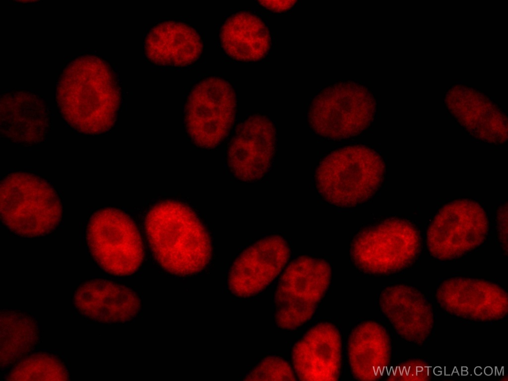 CoraLite®594-conjugated Transketolase Monoclonal antibody