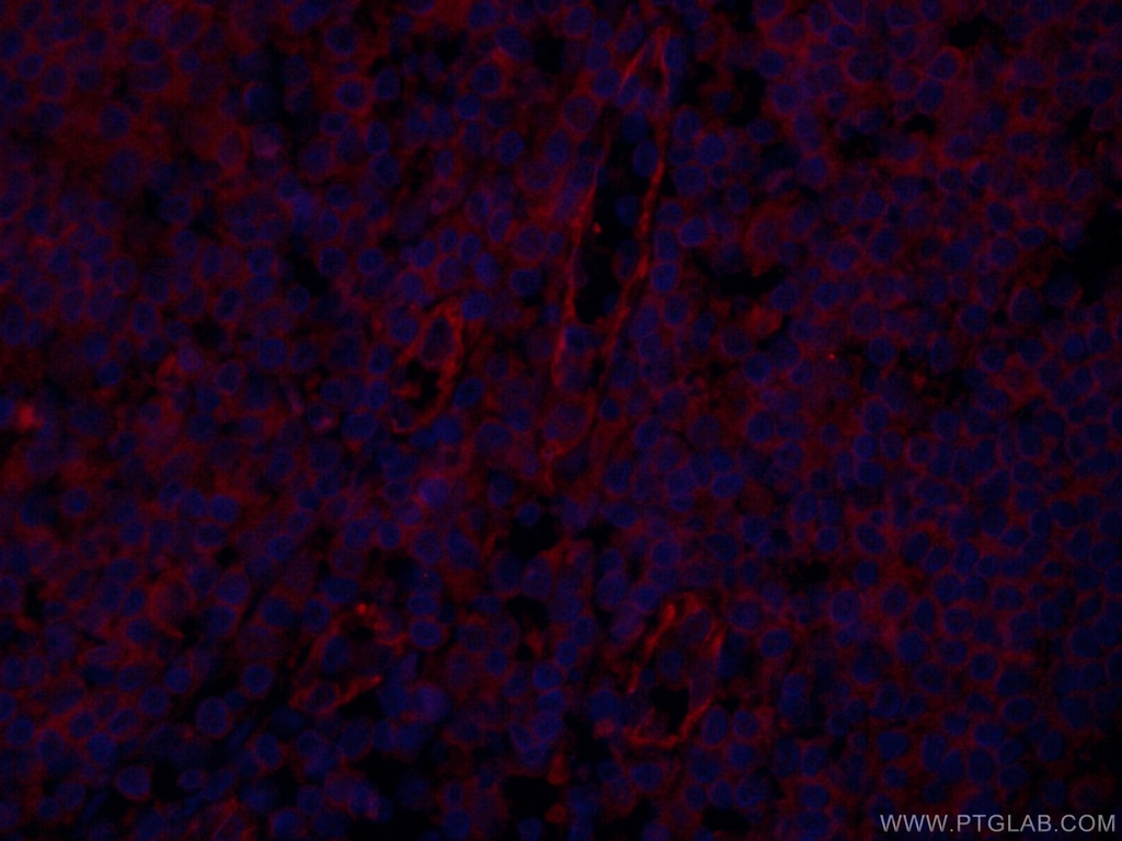 CoraLite®594-conjugated CD31 Monoclonal antibody