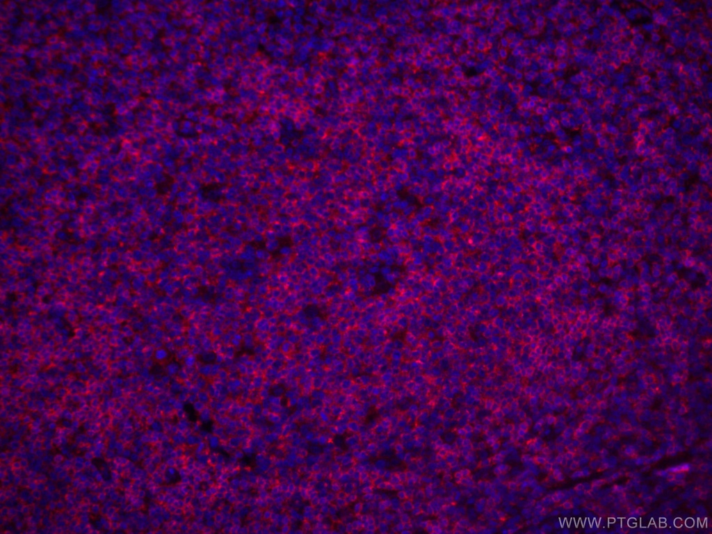 CoraLite®594-conjugated CD22 Monoclonal antibody