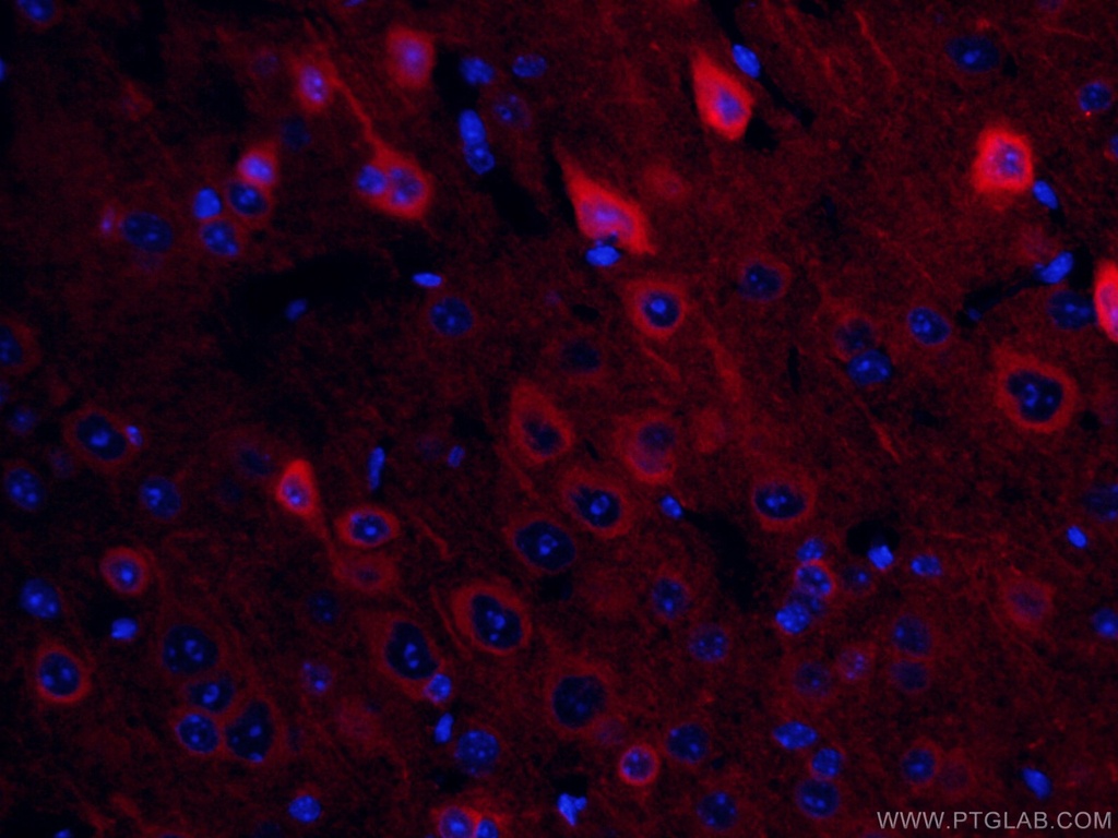 CoraLite®594-conjugated NSE Monoclonal antibody