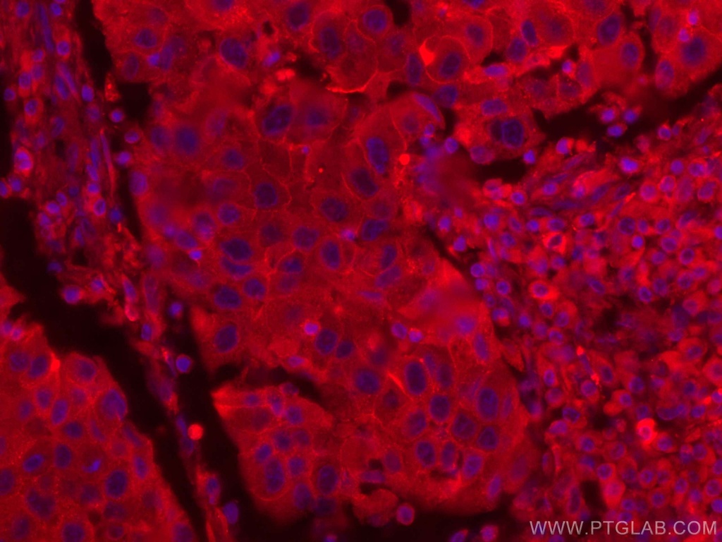CoraLite®594-conjugated CD71 Monoclonal antibody
