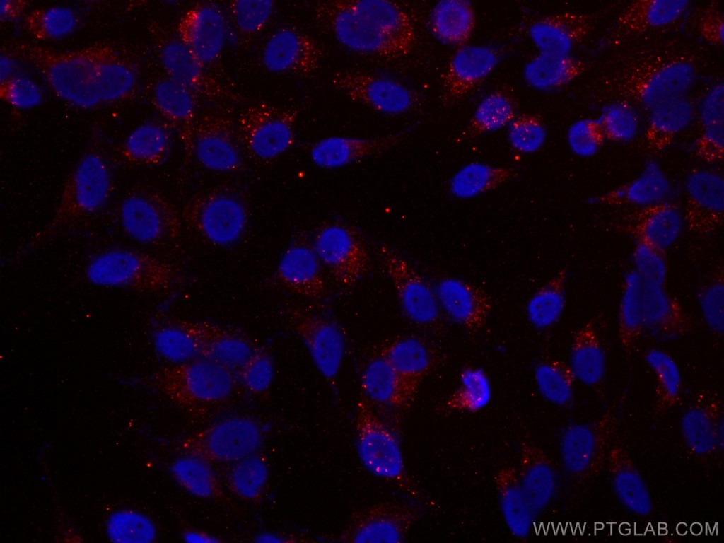 CoraLite®594-conjugated P62/SQSTM1 Monoclonal antibody