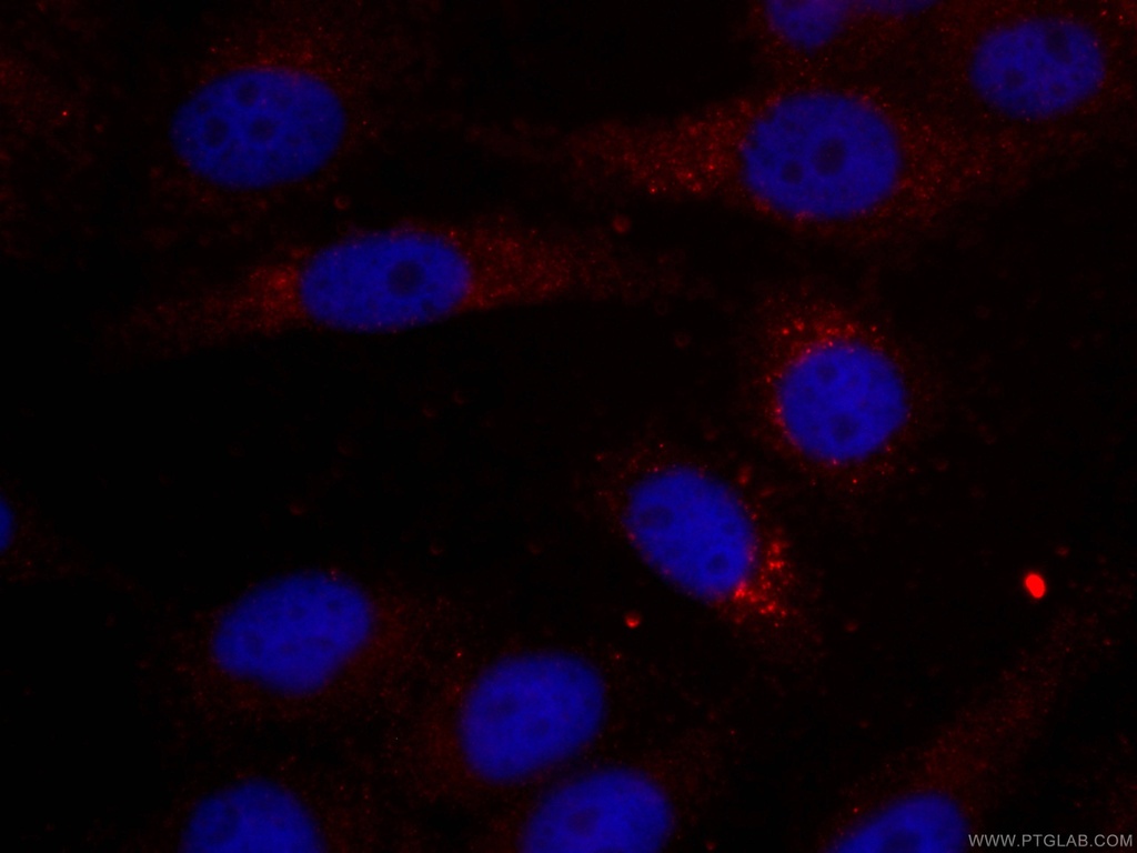 CoraLite®594-conjugated IDH1 Monoclonal antibody