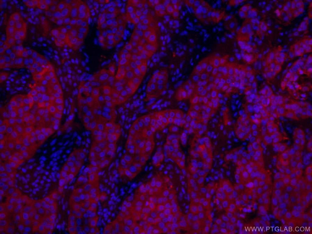 CoraLite®594-conjugated PADI2 Monoclonal antibody